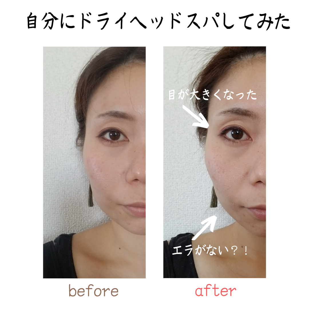 ドライヘッドスパで顔スッキリ♪